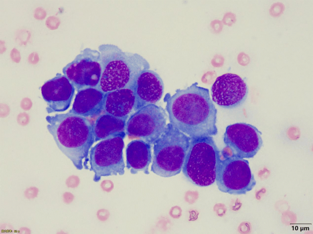 三氣培養(yǎng)箱在腫瘤細胞生物學(xué)研究中的應(yīng)用效能與機制探索